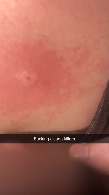 🎸RΩCҜHΣΔD 𝑮𝒚𝒎𝒓𝒂𝒕 🤘🏼