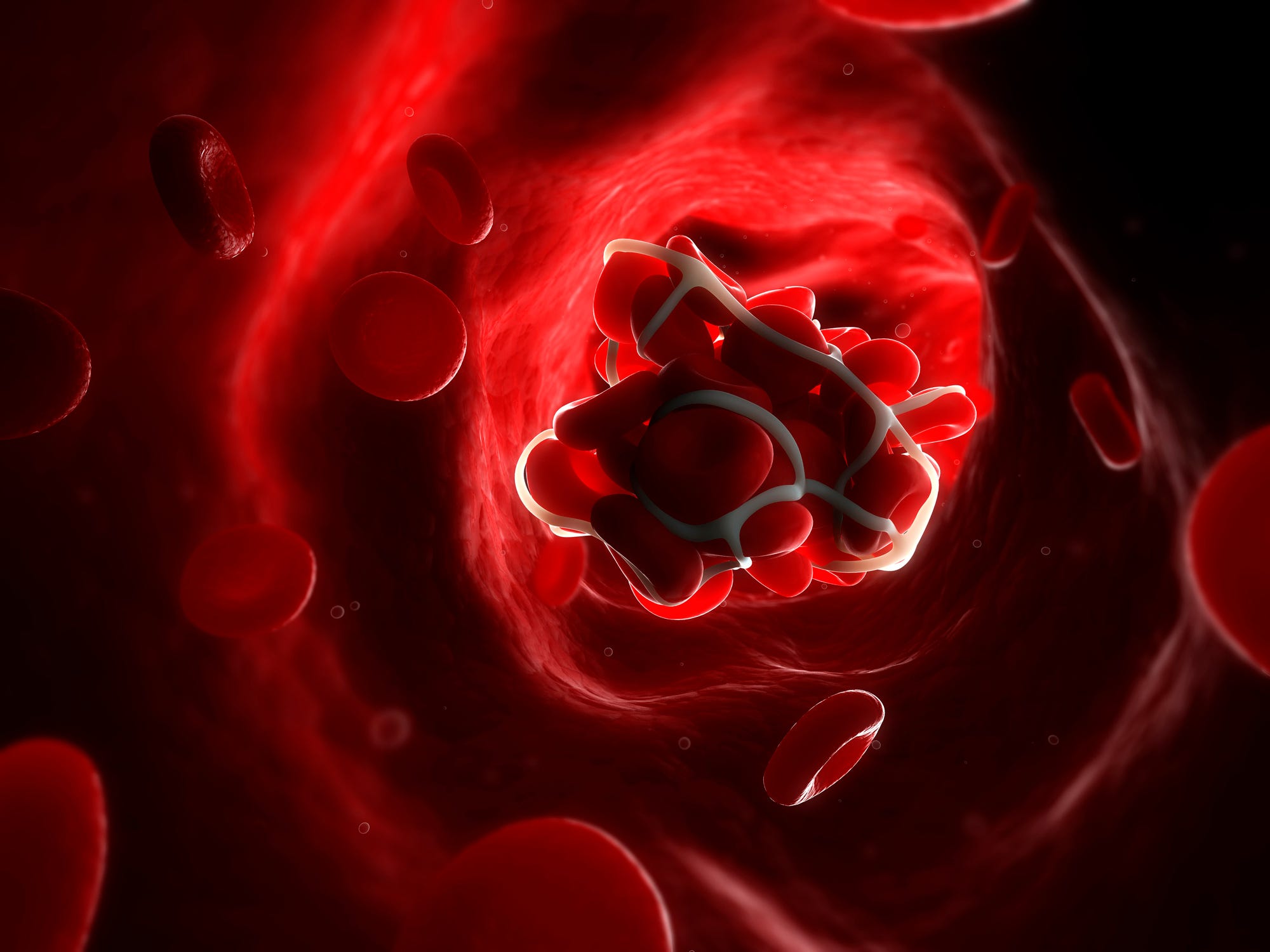 Blood clot 