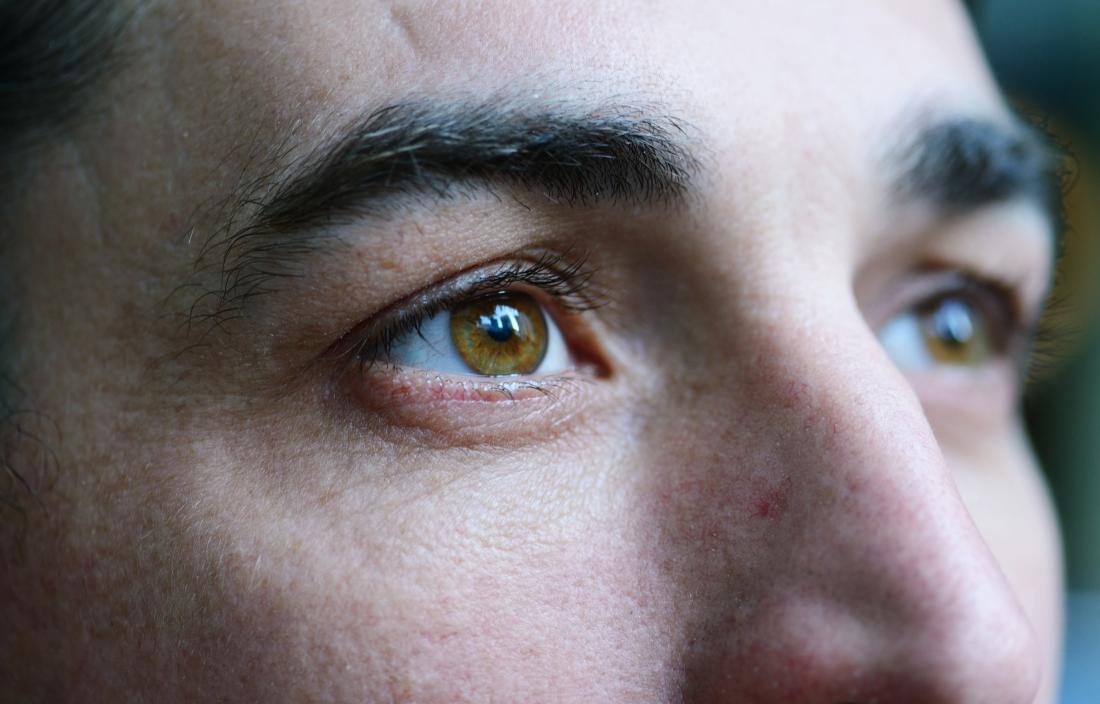 Close up of eyes of person with MS experiencing symptoms affecting vision.