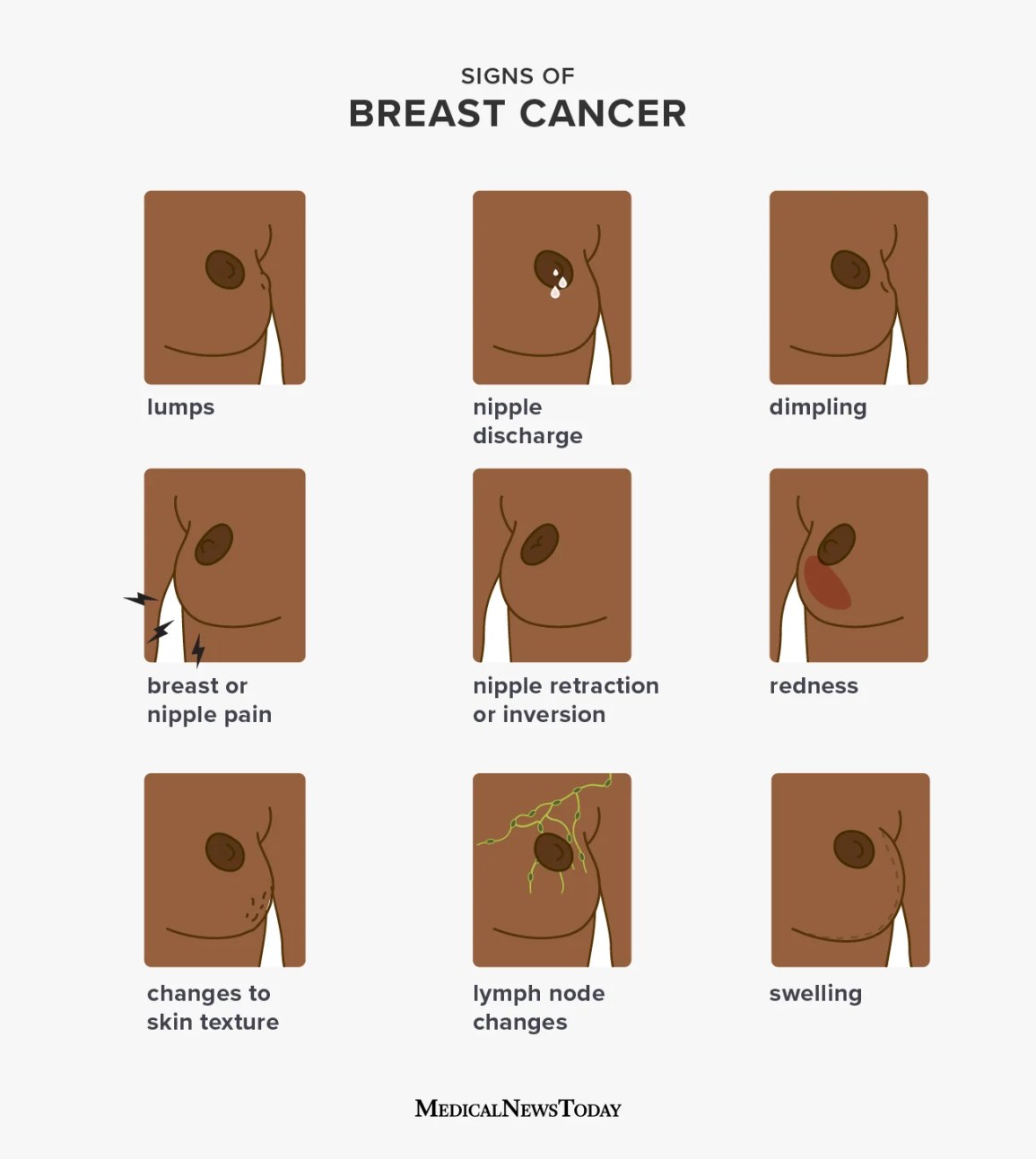 Signs of breast cancer infographic