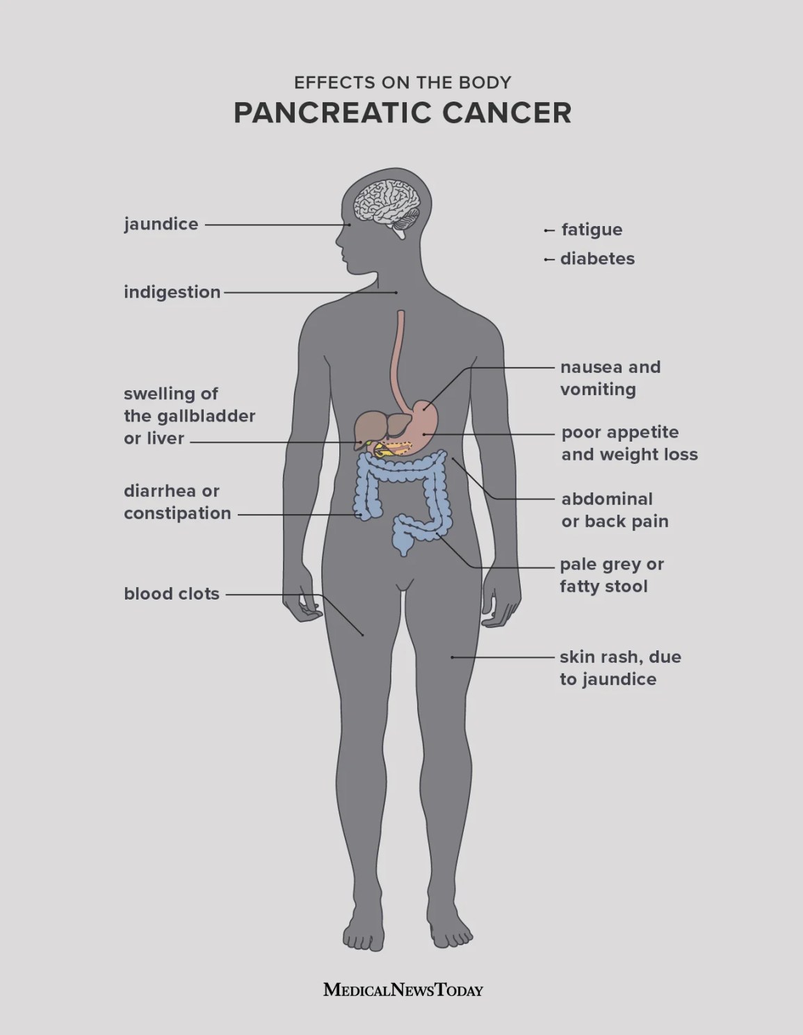 Effects of pancreatic cancer on the body