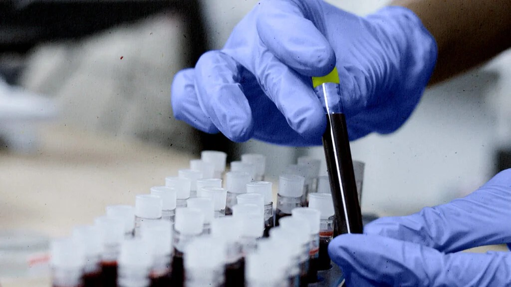 A person holding a vial of blood.