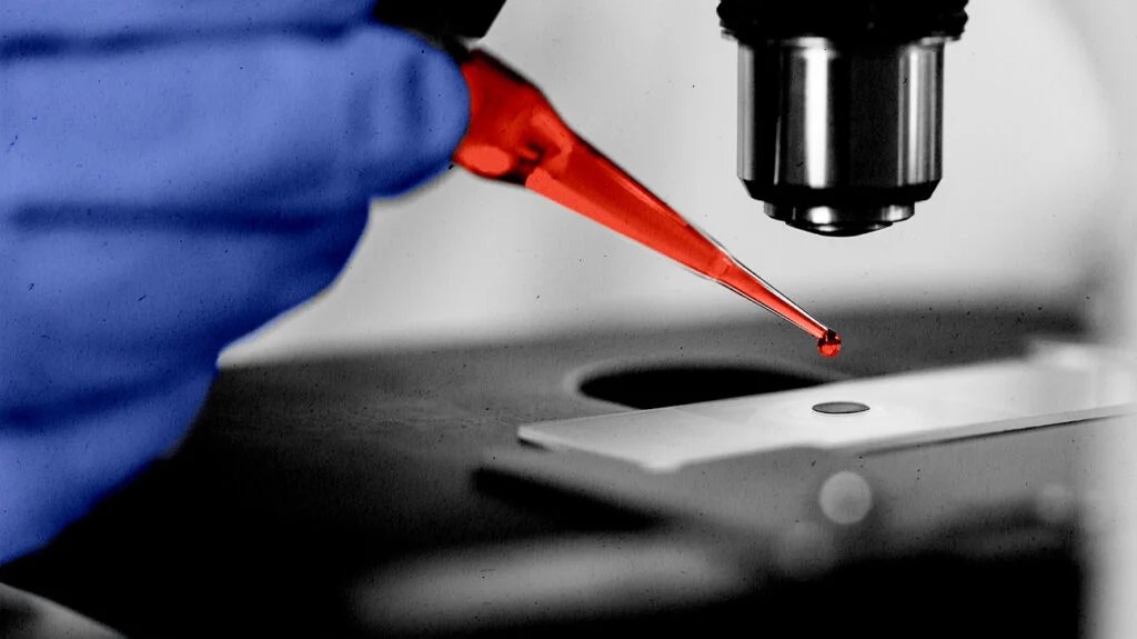 testing blood for leukemia