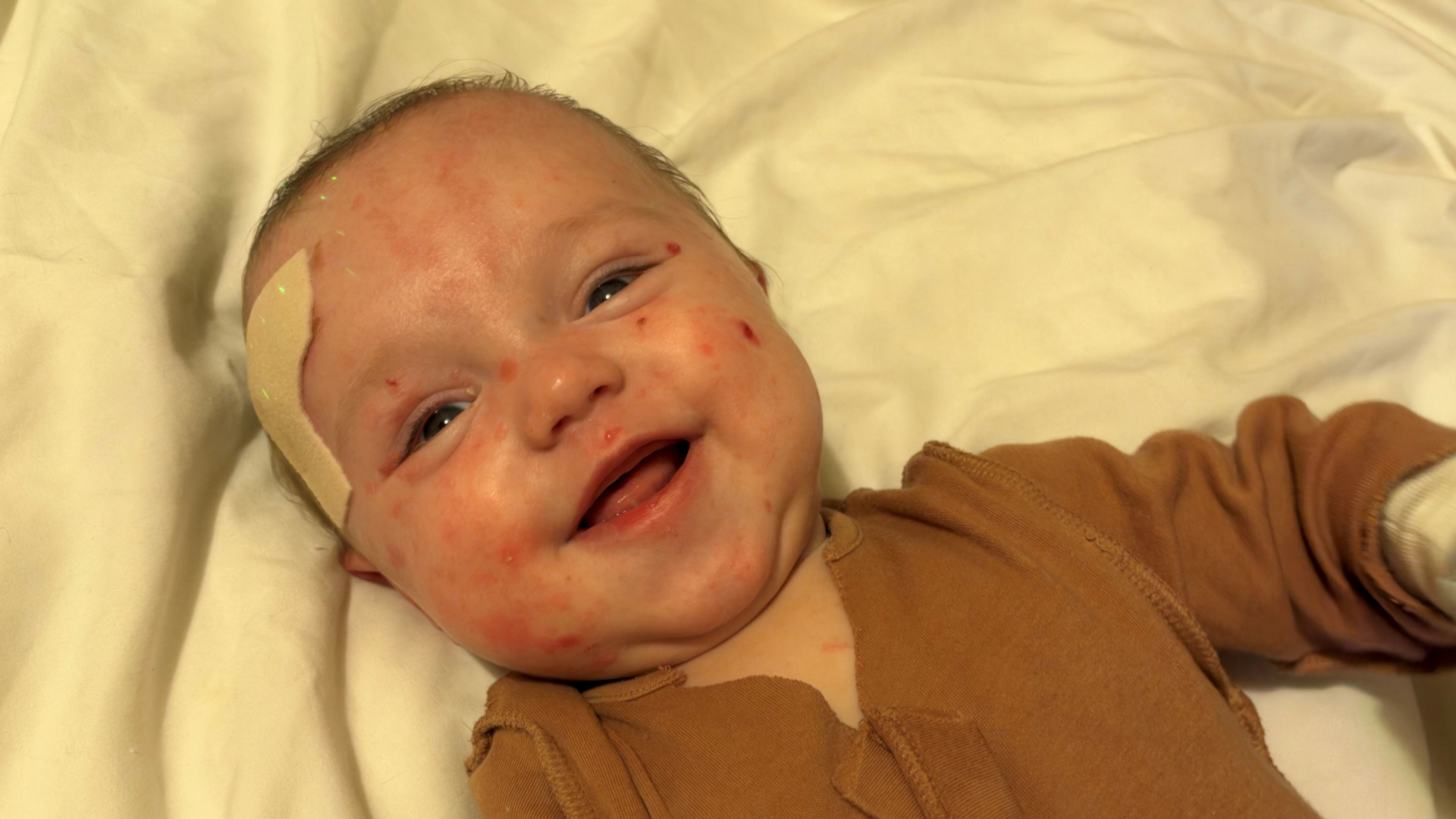 Ciara's son Ralph, who is a baby. He is laid on a duvet and is dressed in a brown coloured baby grow and has a pair of mittens on his hands. He has a plaster on the top of his head. He is looking up at the camera with his mouth open smiling.