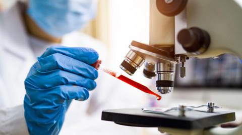 A masked scientist wearing a blue plastic glove holds a pipette full of red liquid under a microscope. 