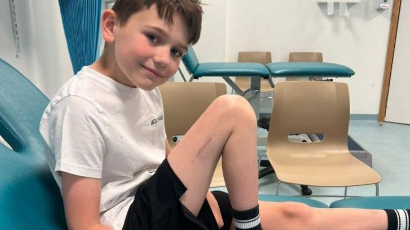Alfie is sat on a hospital treatment bed with his right leg bent up. He is wearing a white t-shit and black shorts and is smiling at the camera.