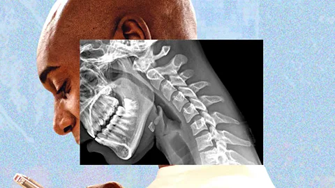 A man looking down, with an X-ray window transposed on his face, showing the curvature of his neck (Credit: BBC/ Serenity Strull/ Getty Images)