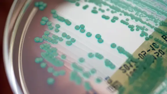 Eine Petrischale mit MRSA-Keimen (Methicillin-resistenten Staphylococcus aureus).