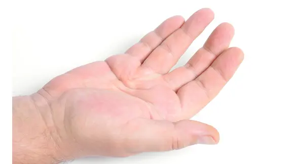 Eine Person mit einer gekrümmten Hand