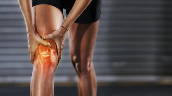 Knieschmerzen: Eine Frau hält sich das schmerzende Knie. Im Knie sieht man eine Grafik vom Kniegelenk.