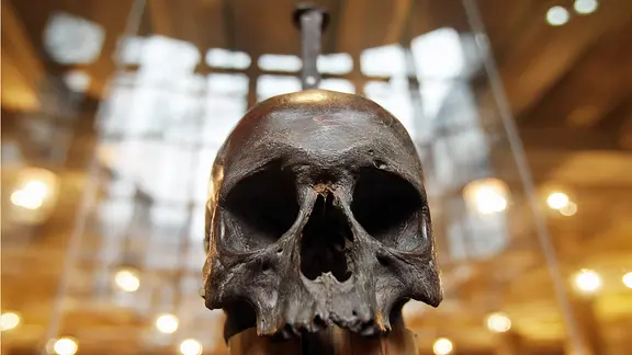 Der Schädel des Seeräubers Klaus Störtebeker, aufgenommen im Museum für Hamburgische Geschichte (18.03.2011)