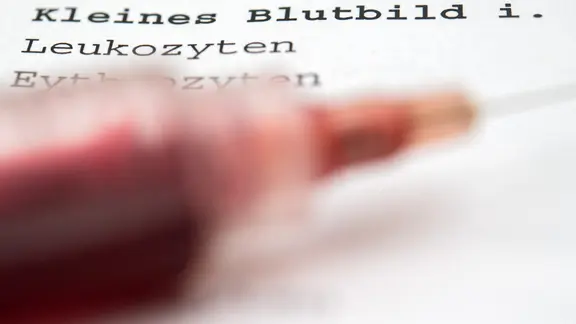 Eine Spitze mit kuenstlichem Blut liegt am 10.07.2018 in Berlin auf einem Bluttest