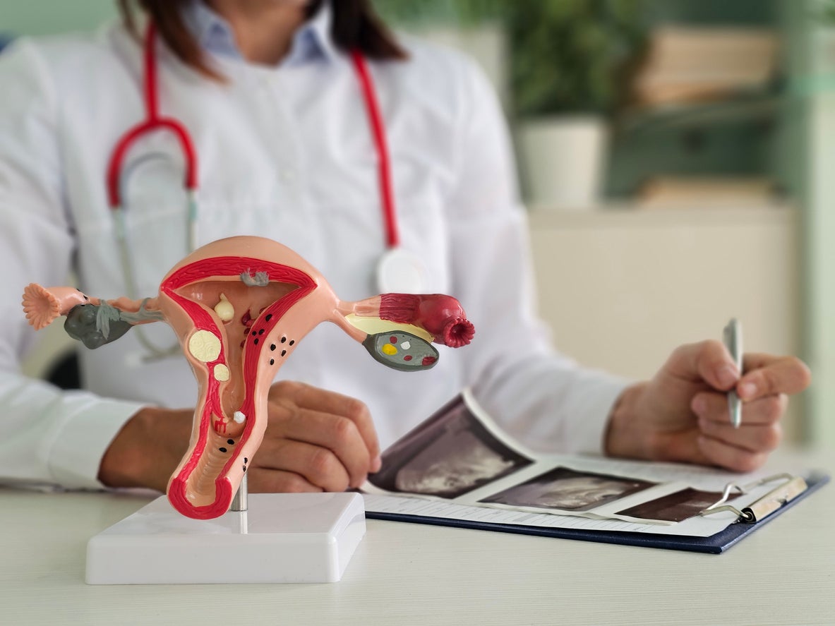 Д-р Димитрина Николова: Кървене след менопауза - симптом, който не трябва да игнорирате