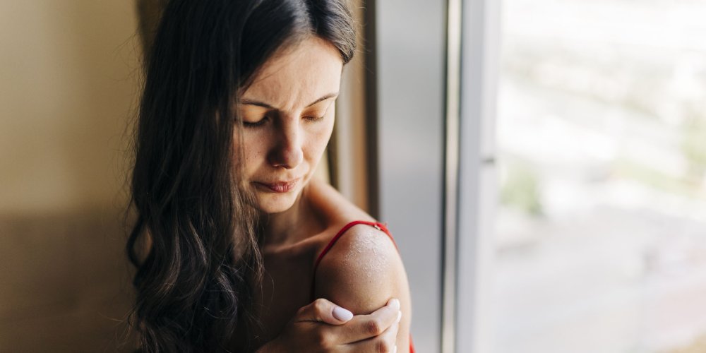 Femme qui regarde son épaule avec une allergie au soleil