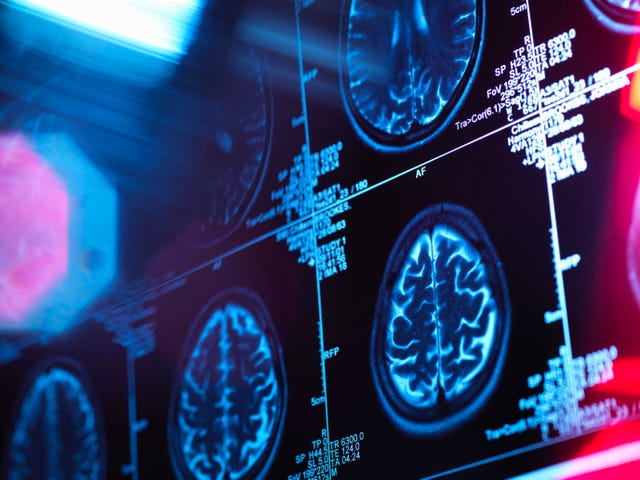 Biggest Risk Factors And Predictors For Dementia biggest risk factors and predictors for dementia