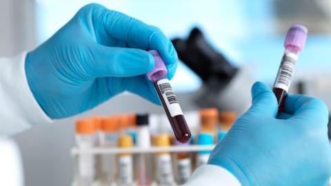 Two gloved hands hold vials of blood. Several vials in a rack can be seen in a blurred background.
