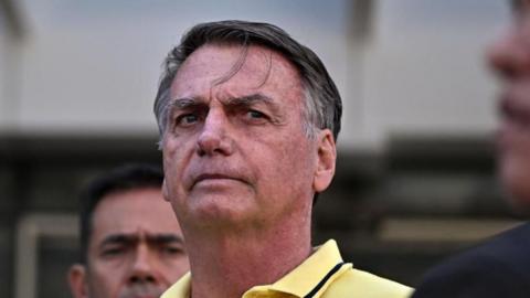Jair Bolsonaro, wearing a pale yellow polo shirt, looks ahead as he leaves a branch of the DF Star hospital services in Brasilia, Brazil, on 16 August 2025. His brow is furrowed and two strand of hair are falling onto his forehead.
