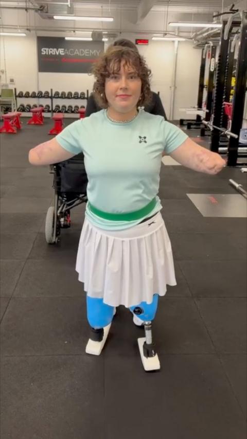 A young lady who had her arms and legs amputated walks on prosthetic legs in a gym