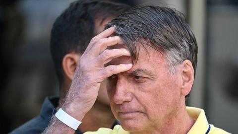 Former Brazilian President Jair Bolsonaro gestures after taking medical tests at DF Star hospital in Brasilia on August 16, 2025. He is wearing a pale yellow polo shirt and touches his forehead with his hand.
