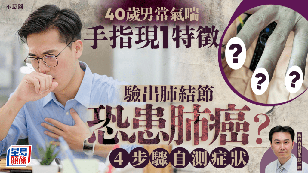 40歲男常氣喘 手指現1特徵驗出肺結節！恐患肺癌？醫生教4步驟自測症狀