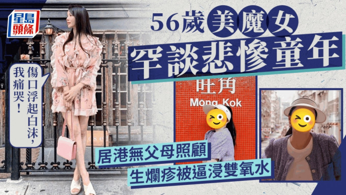 56歲凍齡美魔女自爆有悲慘童年！居港無父母照顧  全身生爛疹被逼浸雙氧水傷口起白沫