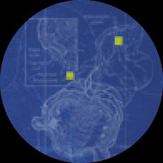 Investigating Ulcerative Colitis thumbnail image