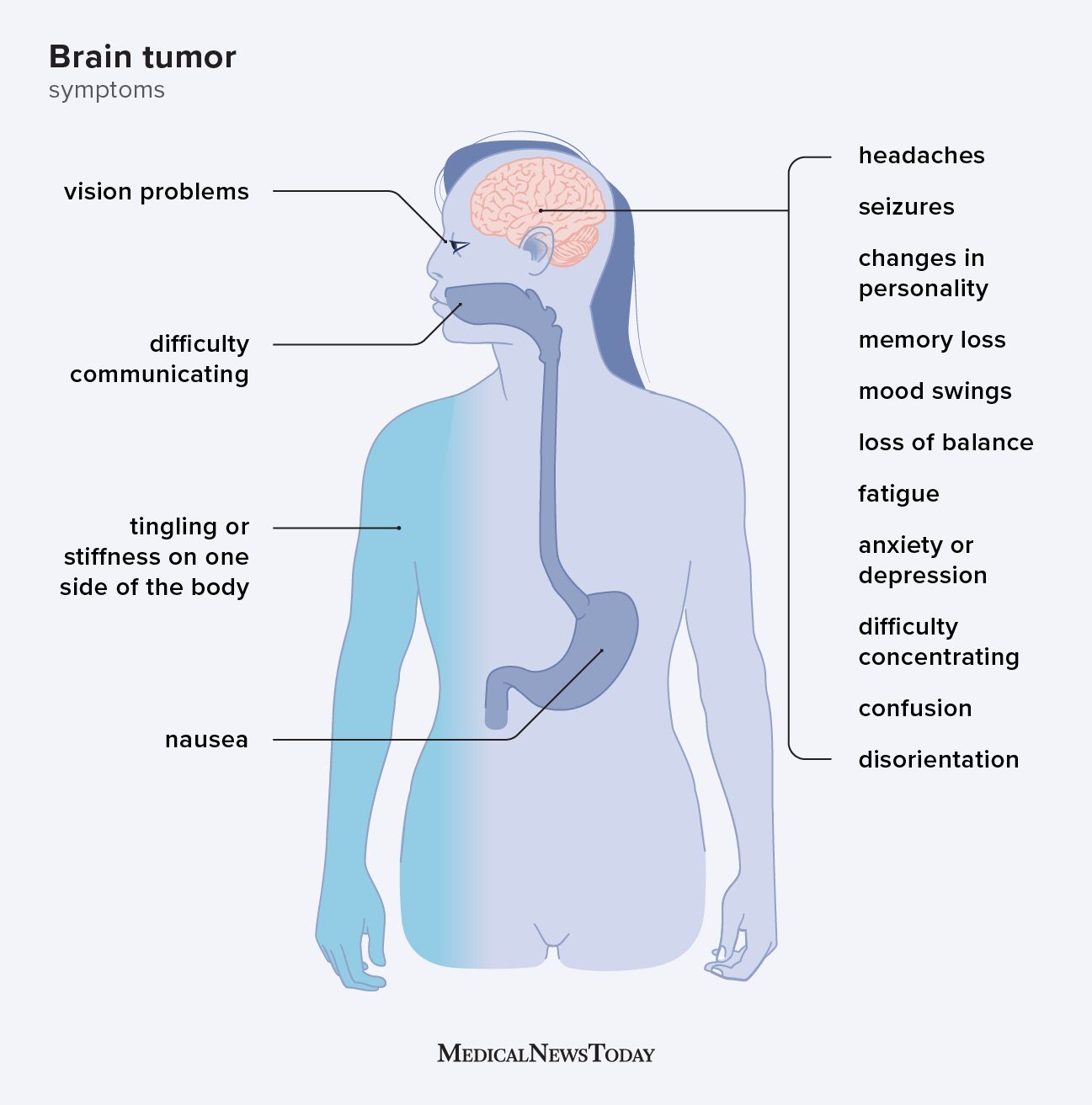 infographic showing the early effects of a brain tumor on the body